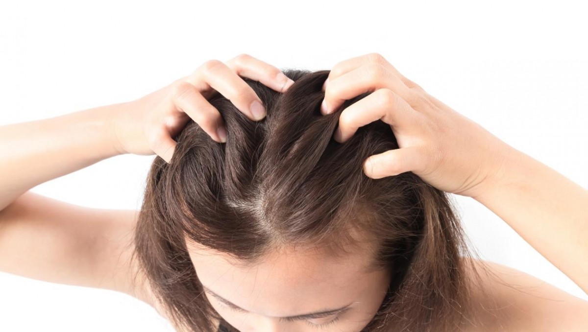 4 myths about lice, get to know them!!